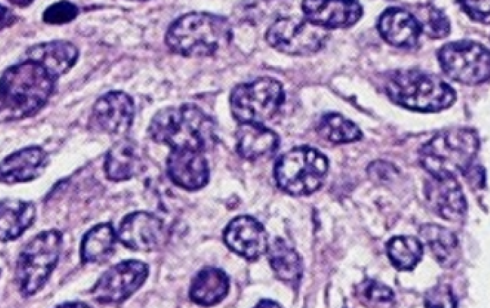 III corso teorico-pratico di Patologia Endocrina
