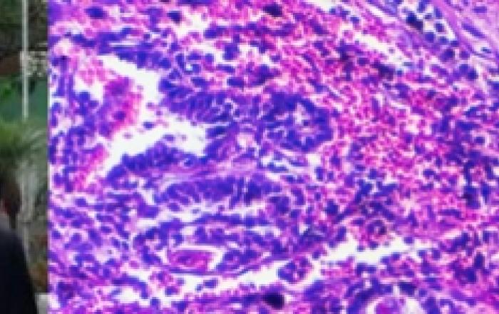 Cordoglio per la scomparsa di Felice Giangaspero, illustre docente di Anatomia patologia